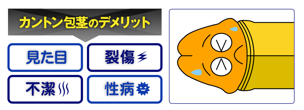 カントン包茎のデメリット