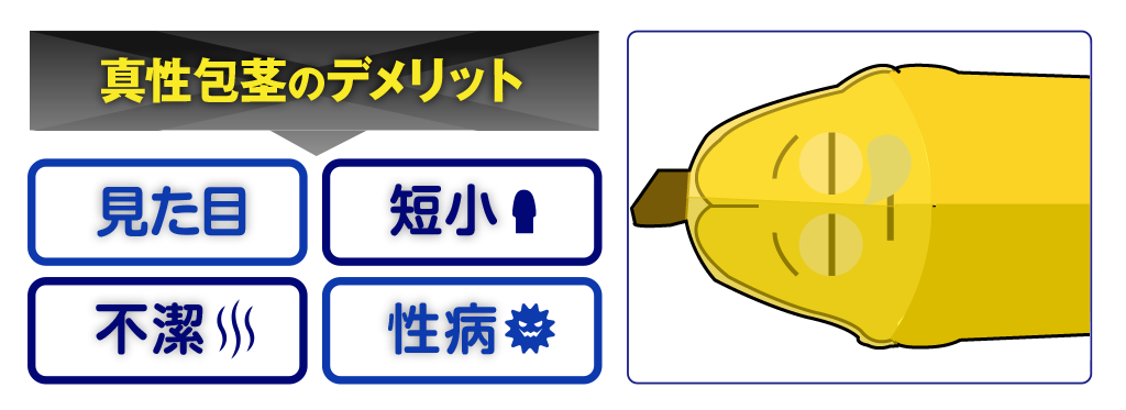 真性包茎のデメリット