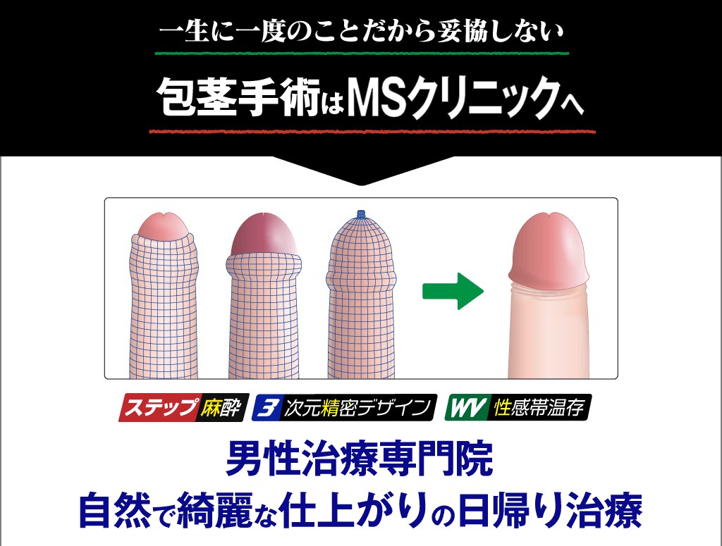 包茎手術は新宿、横浜、名古屋のMSクリニックにお任せください