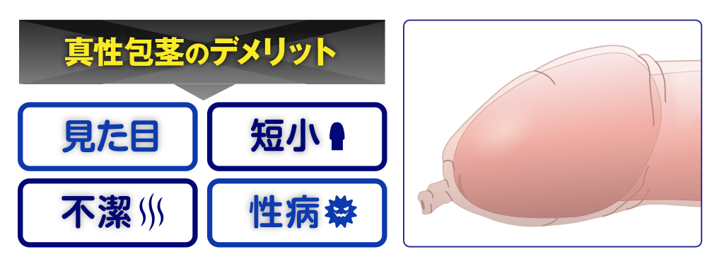 真性包茎のデメリット